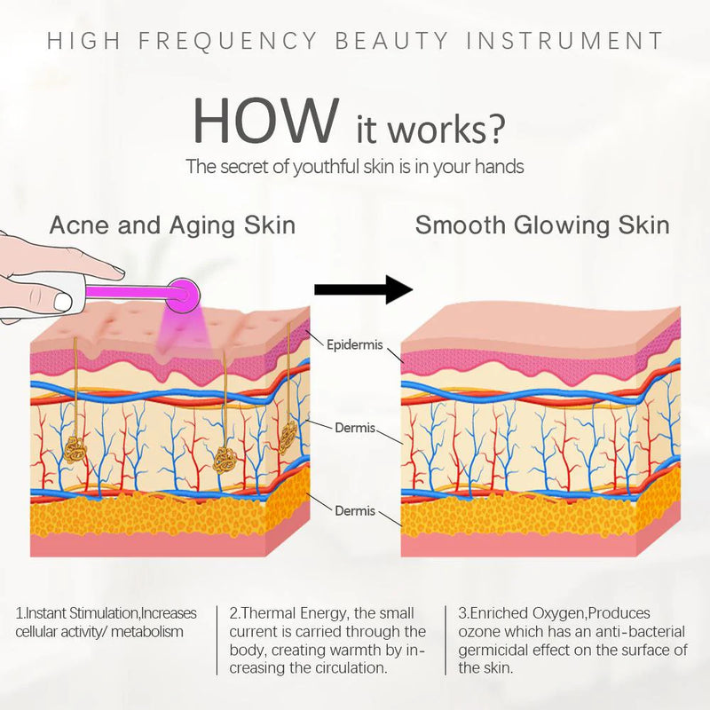 Nuvio High Frequency Acne Wand