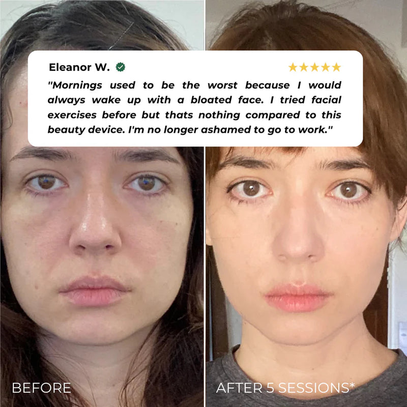 Nuvio EMS Eye Lift Patch